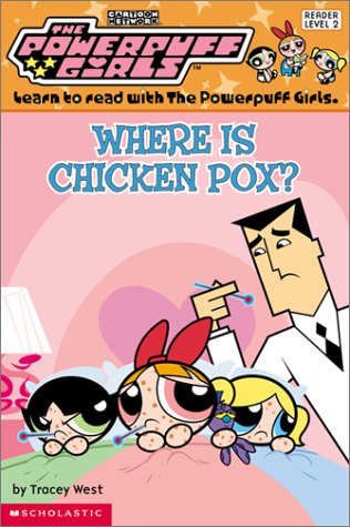 Where is Chicken Pox?