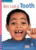 Ben lost a tooth
