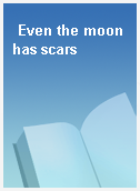 Even the moon has scars
