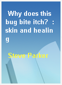 Why does this bug bite itch?  : skin and healing